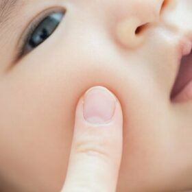 子どもの肌