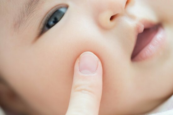 子どもの肌